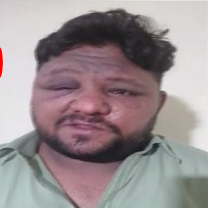 گرین ٹاؤن: ڈولفن فورس کے اہلکاروں کا شہری پر بدترین تشدد