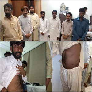 ایف آئی اے اور فوہٹا کی مشترکہ کارروائی ، گردوں اور جگر کی غیر قانونی پیوندکاری میں ملو ث گروہ گرفتار