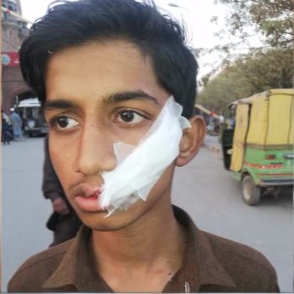 پتنگ بازی کو پولیس روکنے میں ناکام، ڈور پھرنے سے نوجوان زخمی