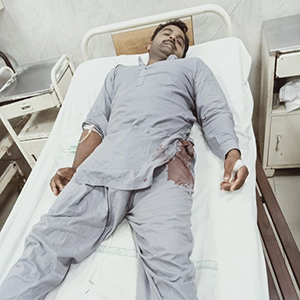 گاؤں جلے کی اور دیوکے میں دوران ڈکیتی تین افراد فائرنگ سے زخمی