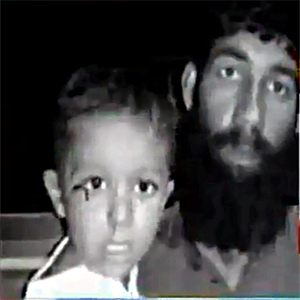 آوارہ کتوں کے کاٹنے سے بچہ شدید زخمی 