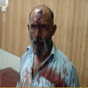 تھانہ سٹی کے علاقہ محلہ شوکت آباد میں فائرنگ